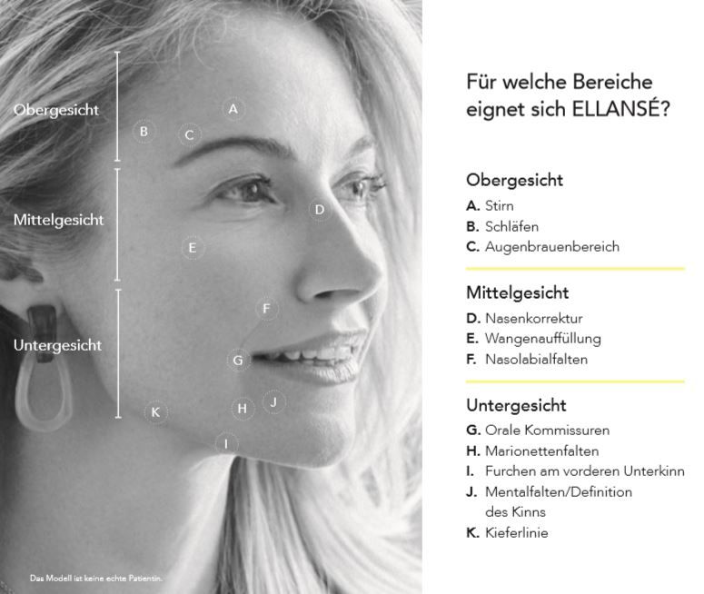 Ellansé eignet sich um Falten zu korrigieren und auch um Wangen und Jawline zu konturieren